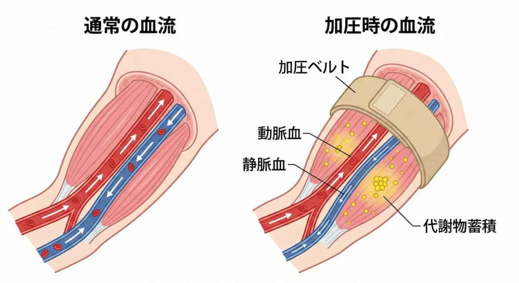 加圧トレーニングとは?