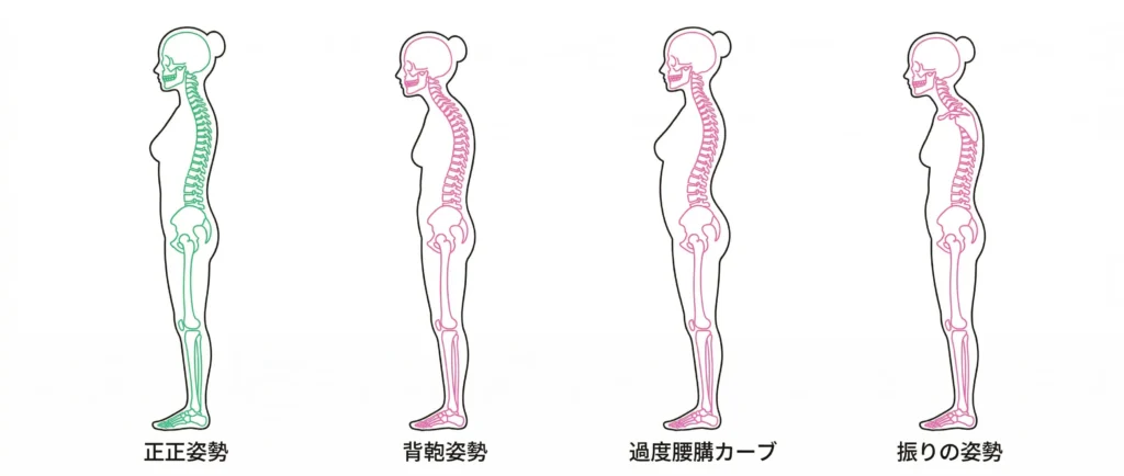 正しい姿勢 vs 悪い姿勢(猫背・反り腰・巻き肩)